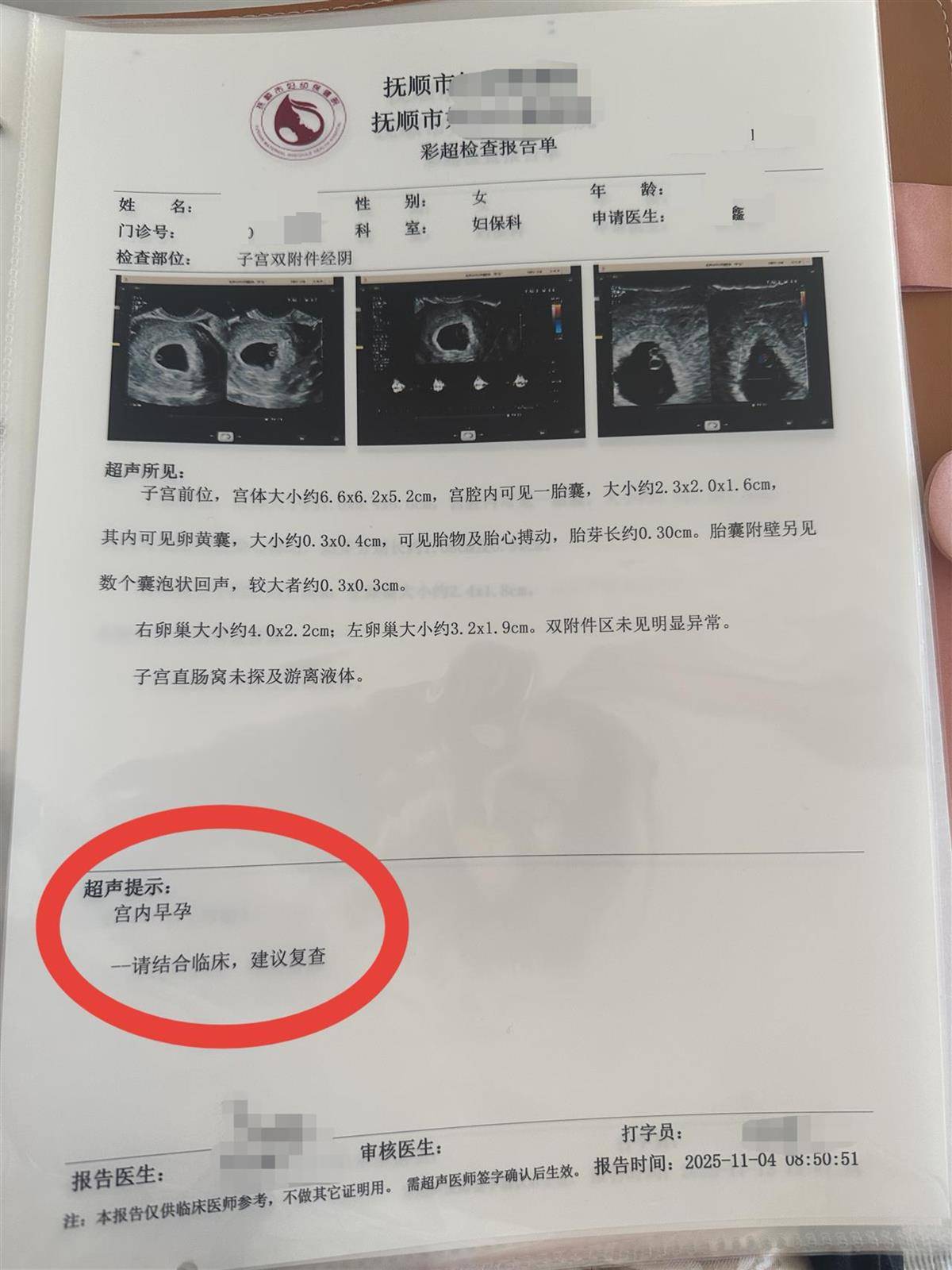 皇冠足球平台_辽宁一孕妇两个月内从一胎变四胞胎皇冠足球平台，每次产检发现多出一胎，医生：系同卵四胞胎，概率1300万至1500万分之一